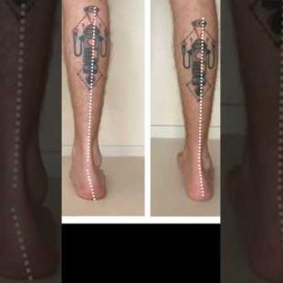 Knee Pain: Can You see it?